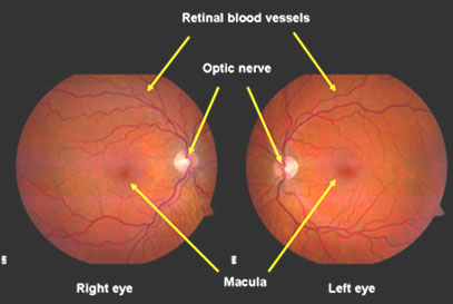 RETINA HOSPITAL